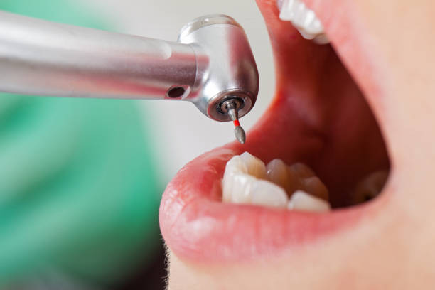 Best Broken or Cracked Tooth Emergency Dentist in Hartford, AL